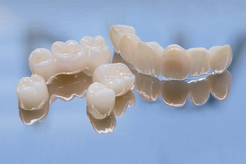 Understanding Dental Crowns: Uses, Materials, and Procedure, Cosmo Dental, San Francisco, CA